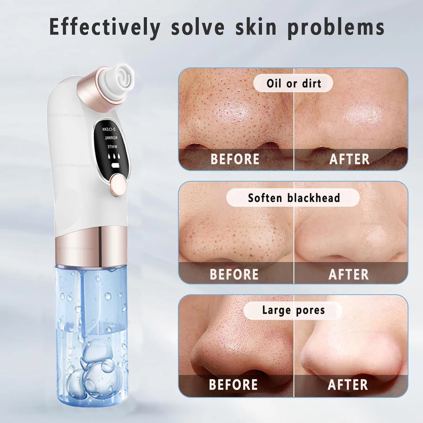 PoreSuction Pro™ Blackhead Remover