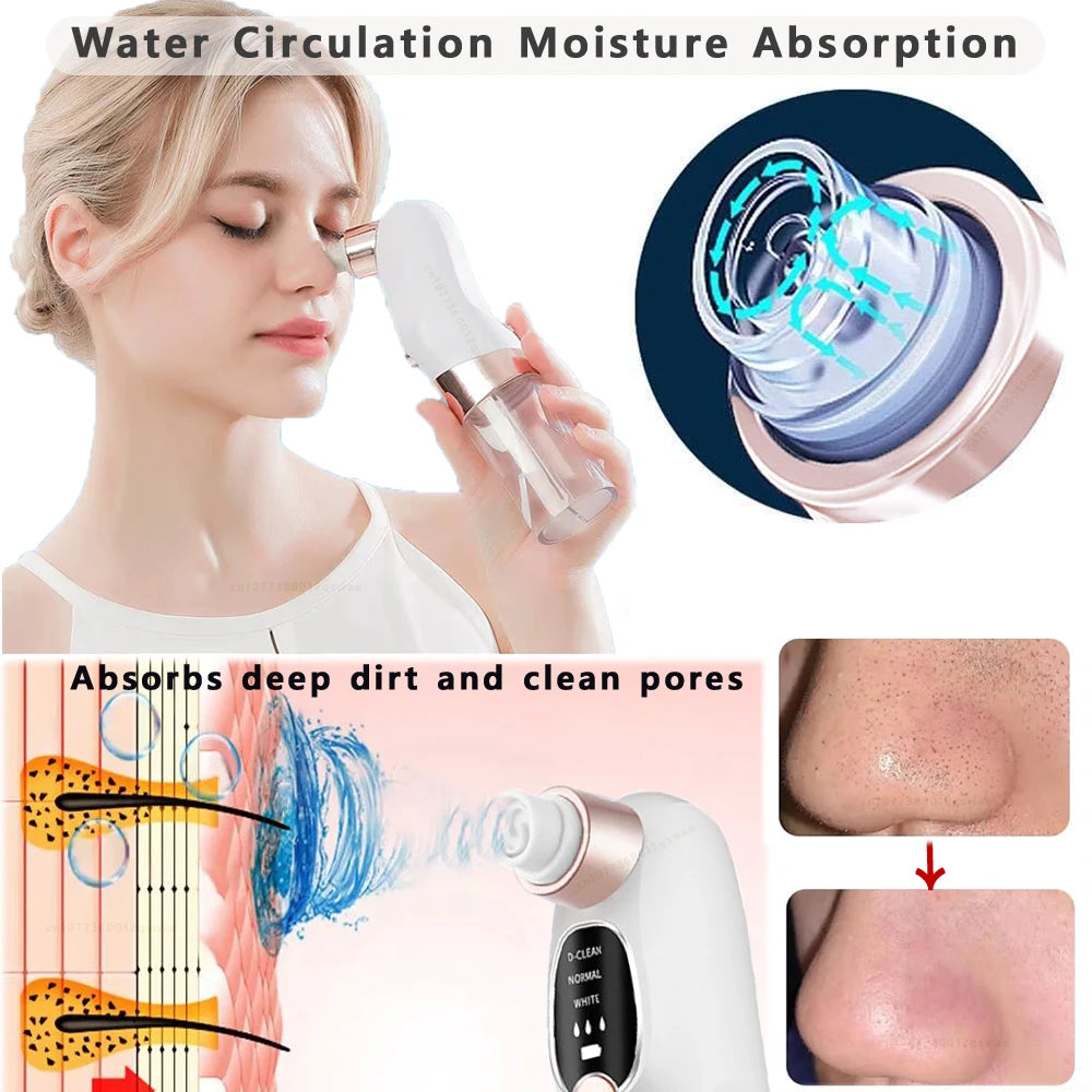 PoreSuction Pro™ Blackhead Remover